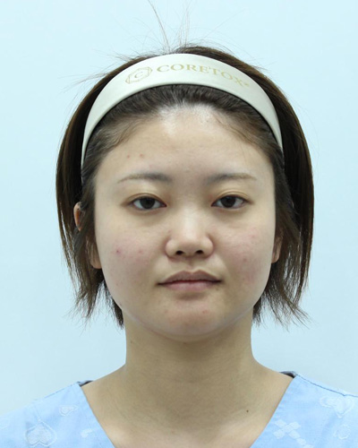Before
