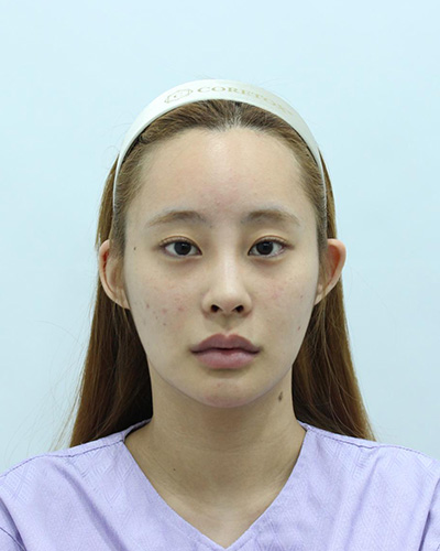 Before