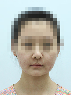 Before