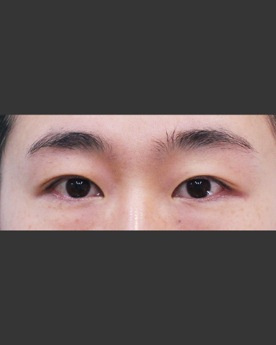 Before