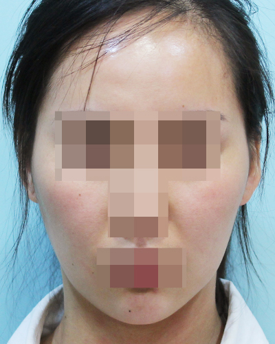After
