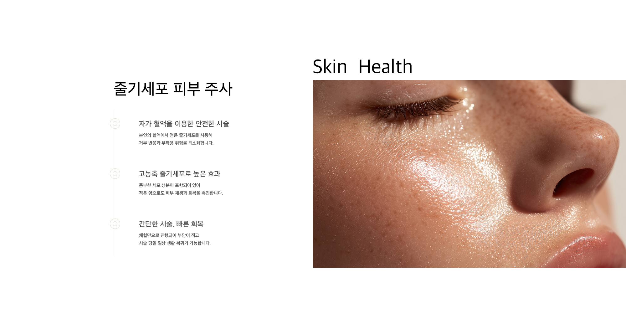줄기세포 피부 주사 1. 자가 혈액을 이용한 안전한 시술 : 본인의 혈액에서 얻은 줄기세포를 사용해 거부 반응과 부작용 위험을 최소화합니다. 2. 고농축 줄기세포로 높은 효과 : 풍부한 세포 성분이 포함되어 있어 적은 양으로도 피부 재생과 회복을 촉진합니다. 3. 간단한 시술, 빠른 회복 : 채혈만으로 진행되어 부담이 적고 시술 당일 일상 생활 복귀가 가능합니다.